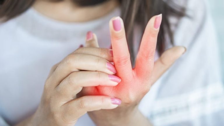 “حكة الأصابع” لدى النساء.. الأسباب والعلاج