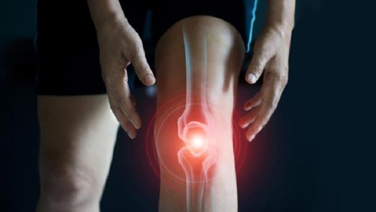 التهاب مفاصل