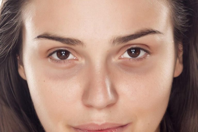 10 عناصر تقلل الهالات السوداء تحت العينين