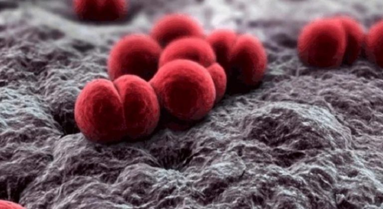 مرض نادر يستهدف الشباب!