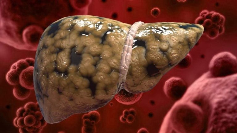 نصائح غذائية.. لكبد سليم