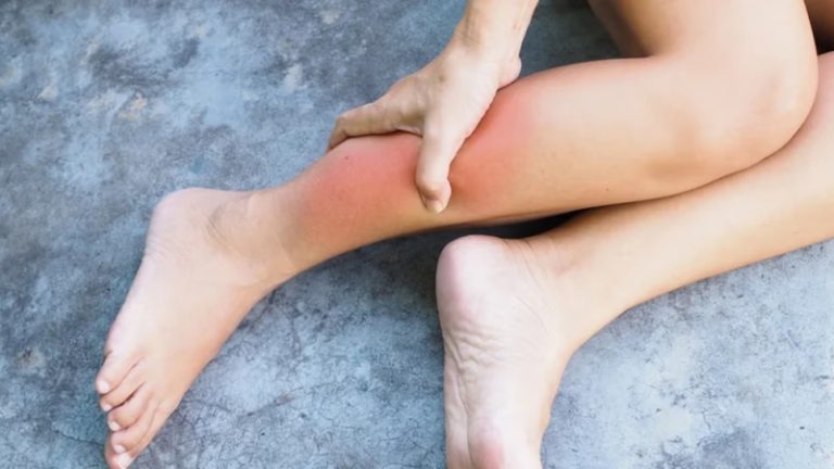 تحذير من إلتهاب النسيج الخلوي.. ما هي أعراضه؟