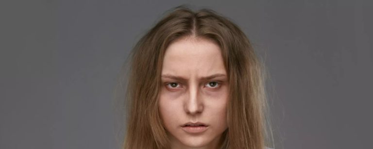 إرتفاع في إصابات فقر الدم.. والنساء أكثر من الرجال!