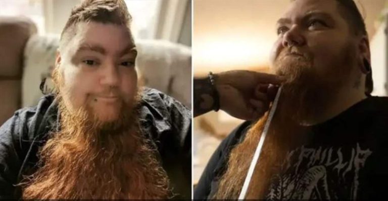 رقم قياسي لإمرأة أميركية.. أطول لحية في العالم!