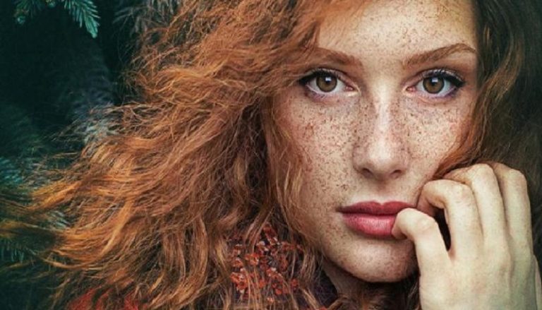 ما علاقة النمش بسرطان الجلد؟