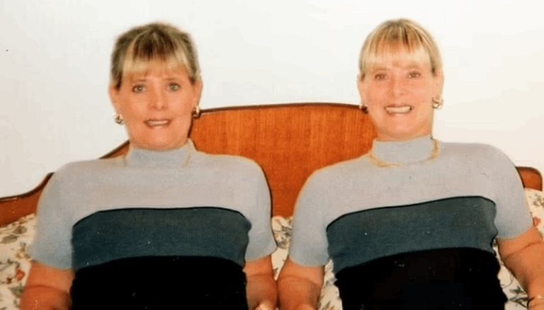 بالصور.. توأمان متطابقتان لبستا الأزياء نفسها لمدة 23 عامًا