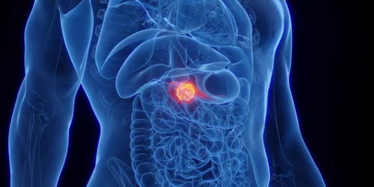 بالفيديو.. تطوير دواء يعالج أحد أخطر السرطانات