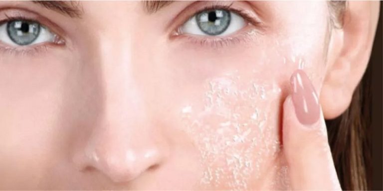 ما هو العلاج الأنسب لتقشر البشرة؟