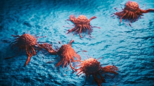 كيف يمكن كشف الأورام الخبيثة؟