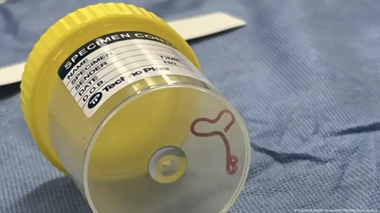 ثعبان في دماغ امرأة.. اغرب الحالات الطبية لعام 2023!