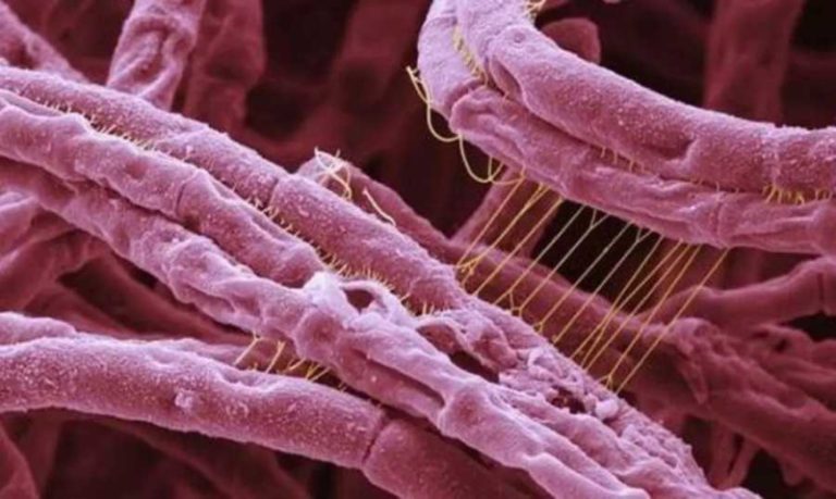 “الصحة العالمية” تحذر من إنتشار “الجمرة الخبيثة”