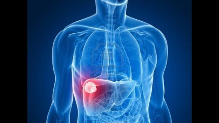 ماذا يحصل للكبد بعد التوقف عن تناول الكحول؟