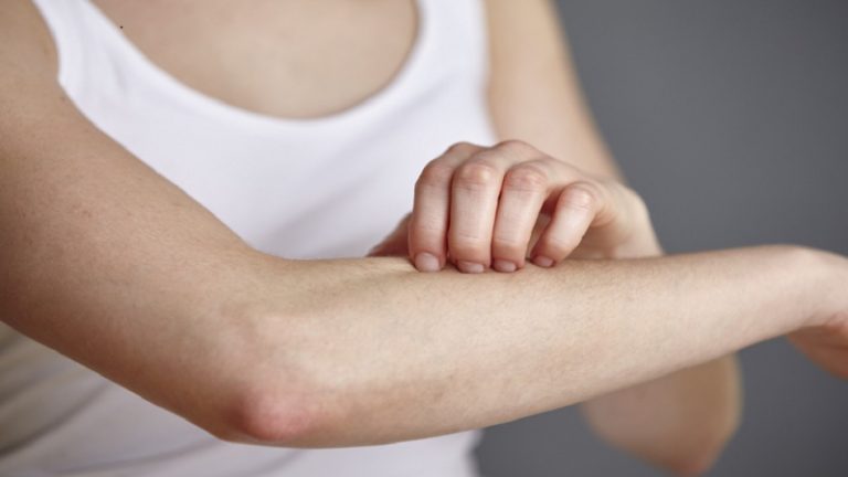 كيف تدلنا بشرتنا عن إصابتنا بالأمراض؟