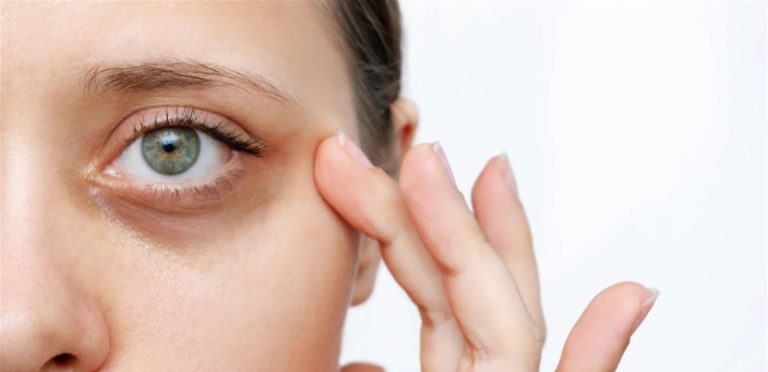 هل من ضرر بإستخدام “كريمات” العيون؟