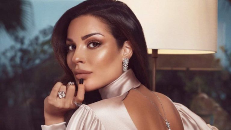 بالصورة.. جروح على وجه نادين نسيب نجيم!