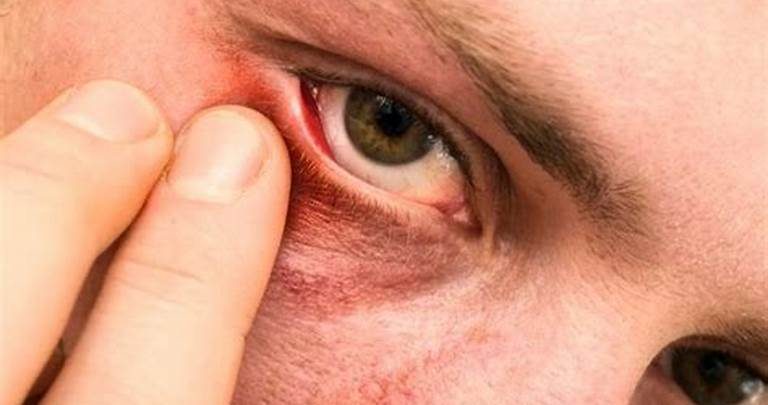 علامات الخرف تظهر في العين؟