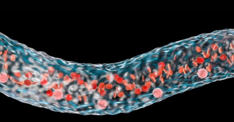 هل يُشفى المصاب بفقر الدم الخبيث؟