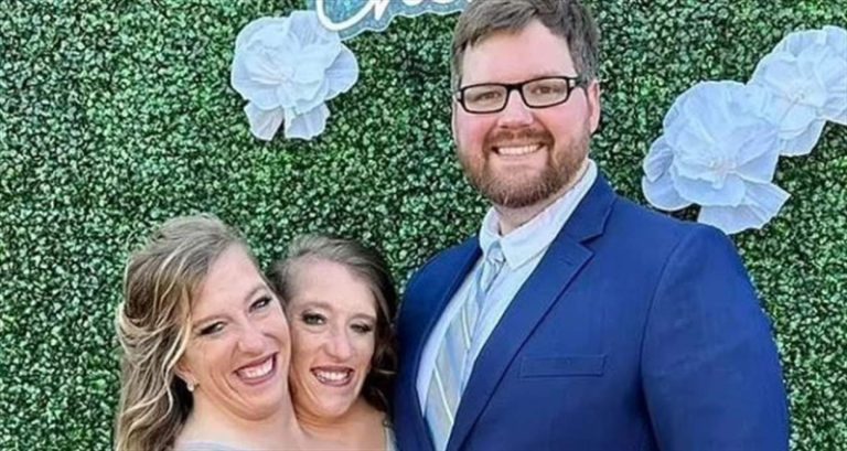 بالصورة.. زواج التوأم الملتصق الأميركي الشهير!