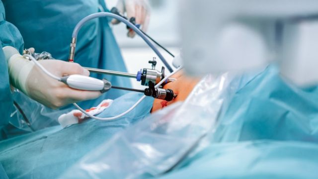 هل من الممكن الصيام بعد جراحة البدانة؟