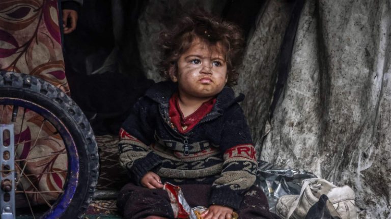 البطون في غزة خاوية!