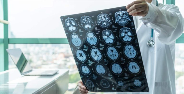 “يرى البشر على هيئة شياطين”.. إضطراب من نوع جديد!