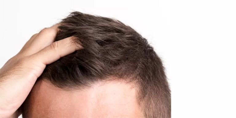 لماذا تظهر بثور في فروة الرأس؟