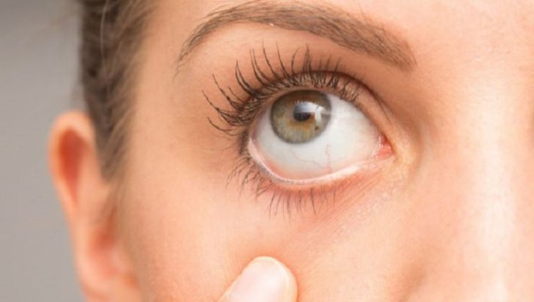 ما هي أسباب جفاف العين؟