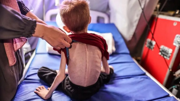 “هيومن رايتس ووتش”: التجويع هو سلاح يقتل الأطفال