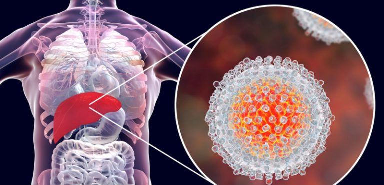 40 حالة التهاب الكبد الوبائي في البقاع الغربي