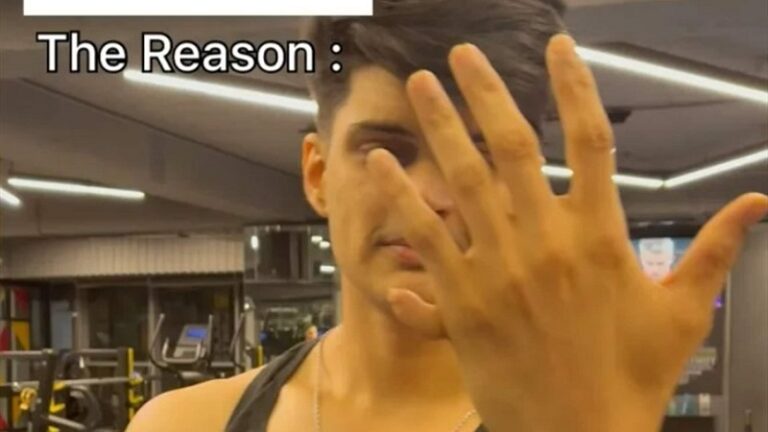 ولد بـ 12 اصبعاً وأذهل متابعيه بمواهبه! (صور)