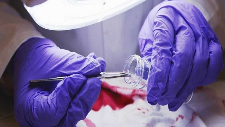 اقتراح قانون جديد لتنظيم مهام الطب الشرعي