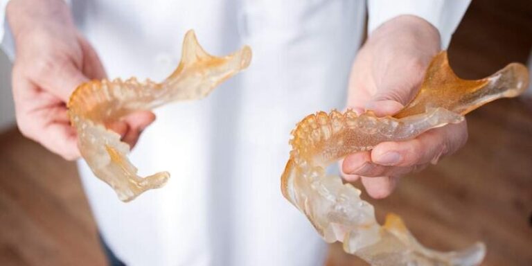 ابتكار طرف اصطناعي للوجه والفكين