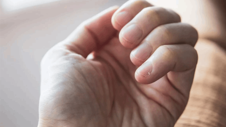 هل تستمر الأظافر والشعر بالنمو بعد موت الانسان؟