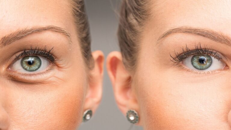 خطوات لبشرة أكثر نضارة حول العين!