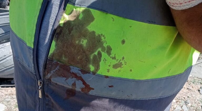 إصابة مسعفَين بالغارة على حولا (صور)