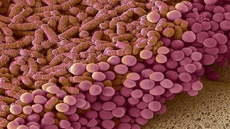 كيف نعزز صحة الأمعاء؟