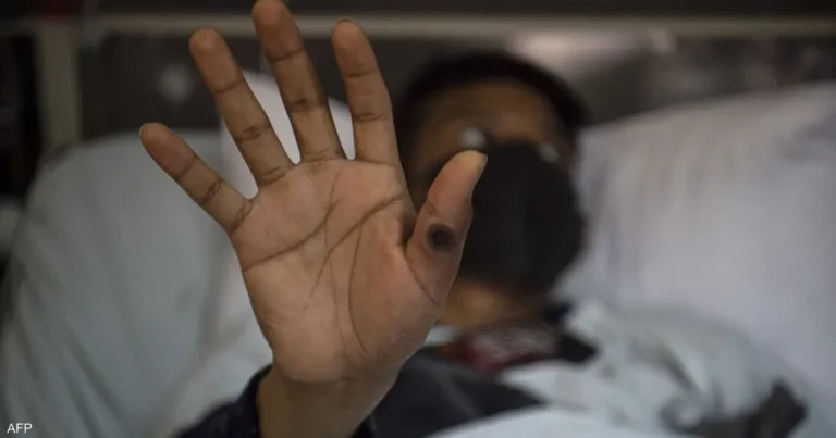 جدري القردة ينتشر في أفريقيا