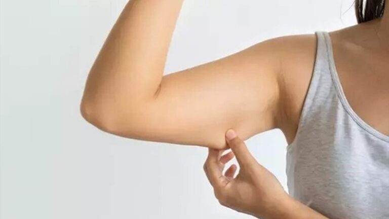 صلة غير متوقعة بين الدهون حول الذراعين والأمراض الخطيرة