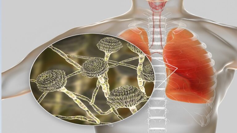 فطر قاتل يجتاح أراضي الولايات المتحدة
