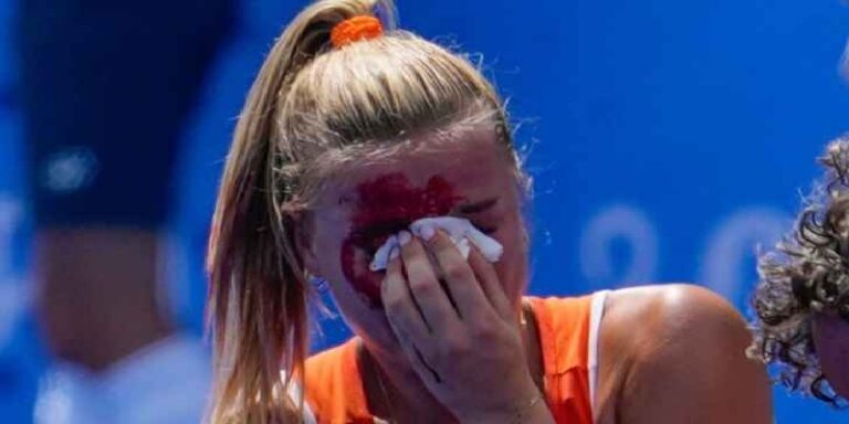 لاعبة هولندا للهوكي تتعرض لإصابة قوية