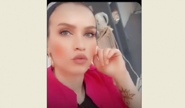 تعميم صورة مفقودة في القبة