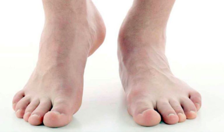 ما علاقة نعومة القدمين بأمراض القلب؟