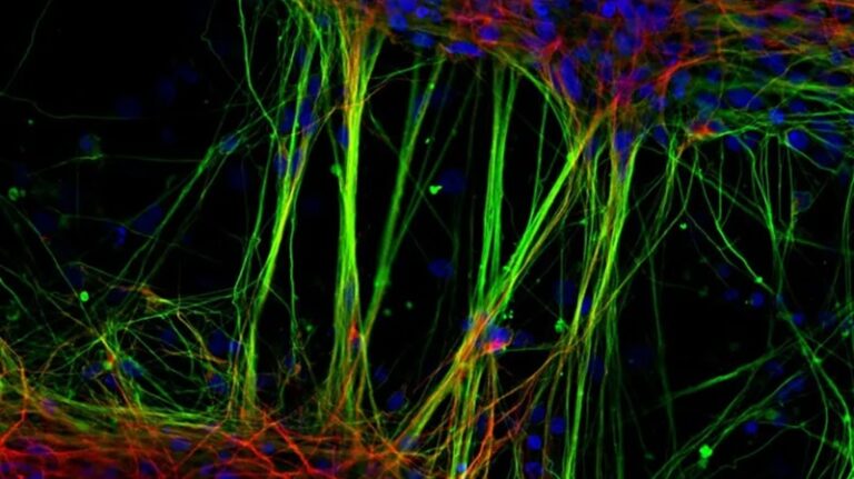 “دماغ صغير” داخل القلب!