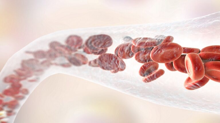 أخطاء في علاج ارتفاع ضغط الدم