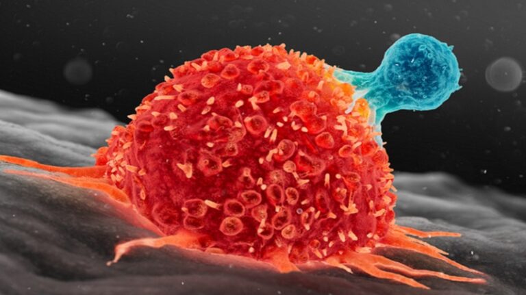  مضادات الاكتئاب تقاوم السرطان؟