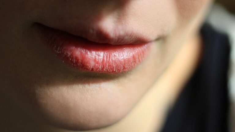 ترطيب الشفاه أثناء الصيام