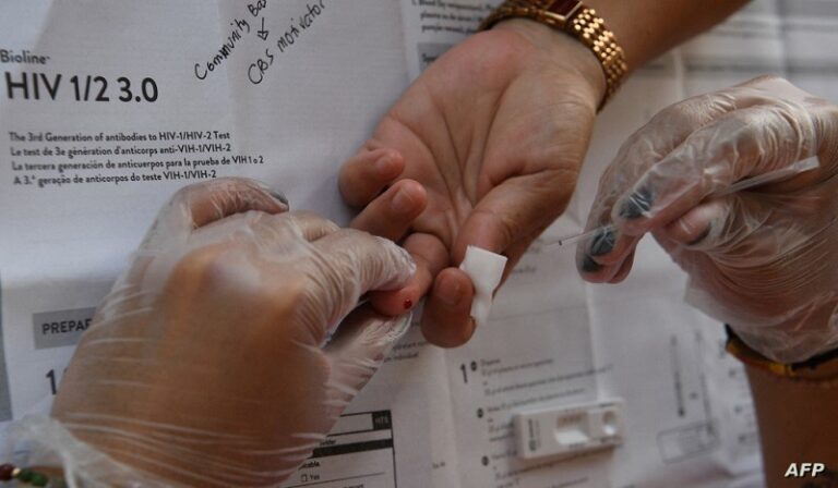 ما هي أعراض فيروس نقص المناعة؟