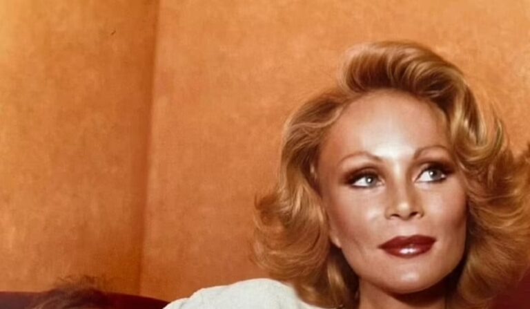 بالصورة.. وفاة “المرأة القطة”