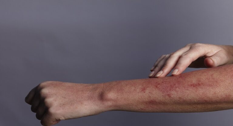 أسباب صحية للحكة الجلدية!