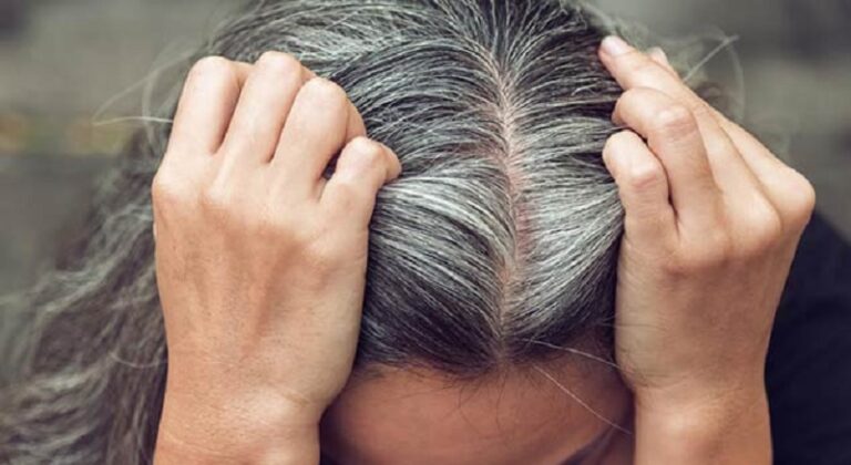 أطعمة تحارب الشيب المبكر!